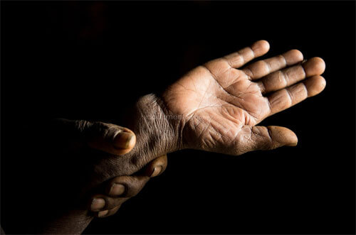 Semebtu Chokole, 50-55, shows her broken wrist, Adi Sibhat, Tigray, Ethiopia<p>© Guilhem Alandry</p>