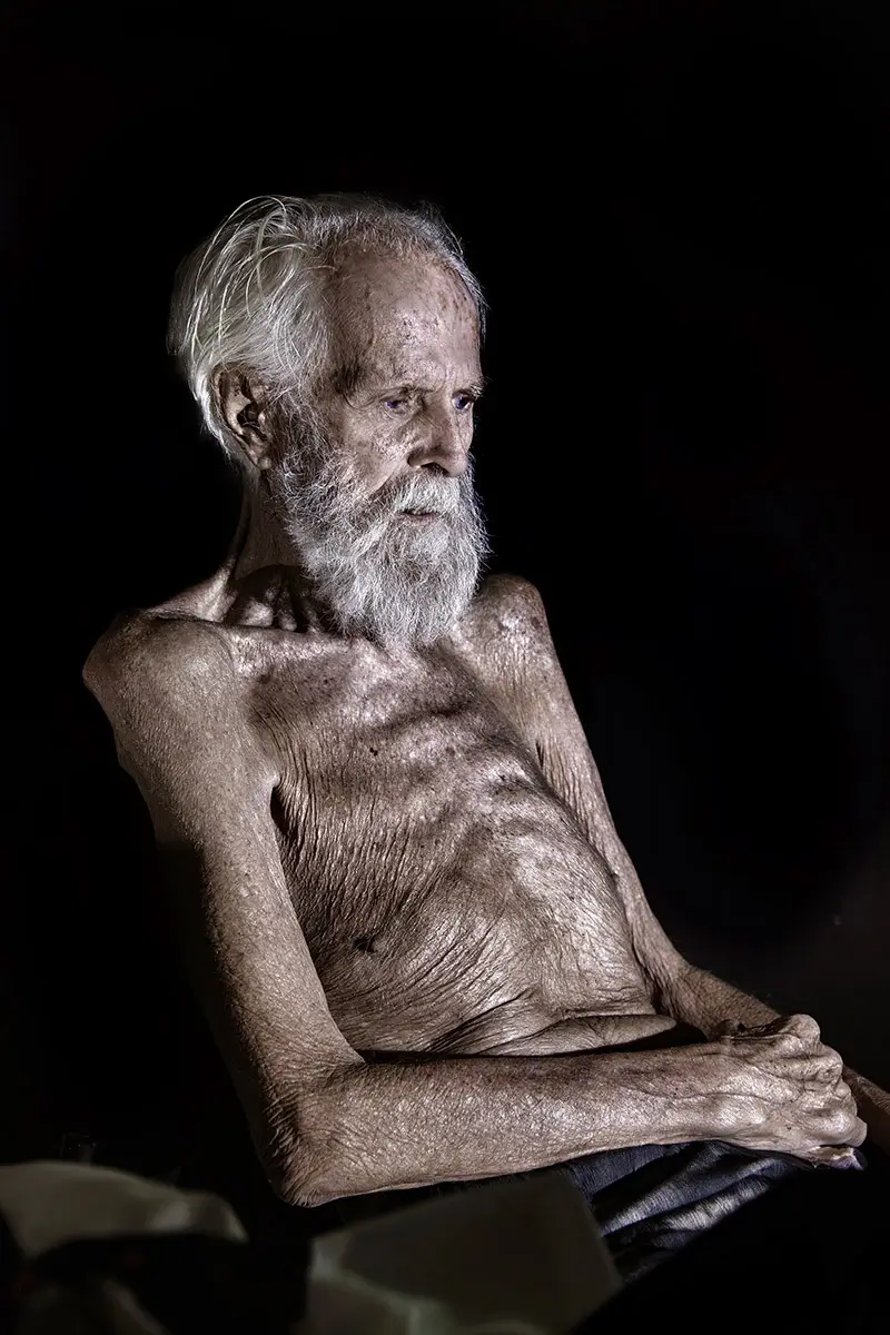 Millionaire Castaway - David Glasheen recovering from a heart attack<p>© Brian Cassey</p>