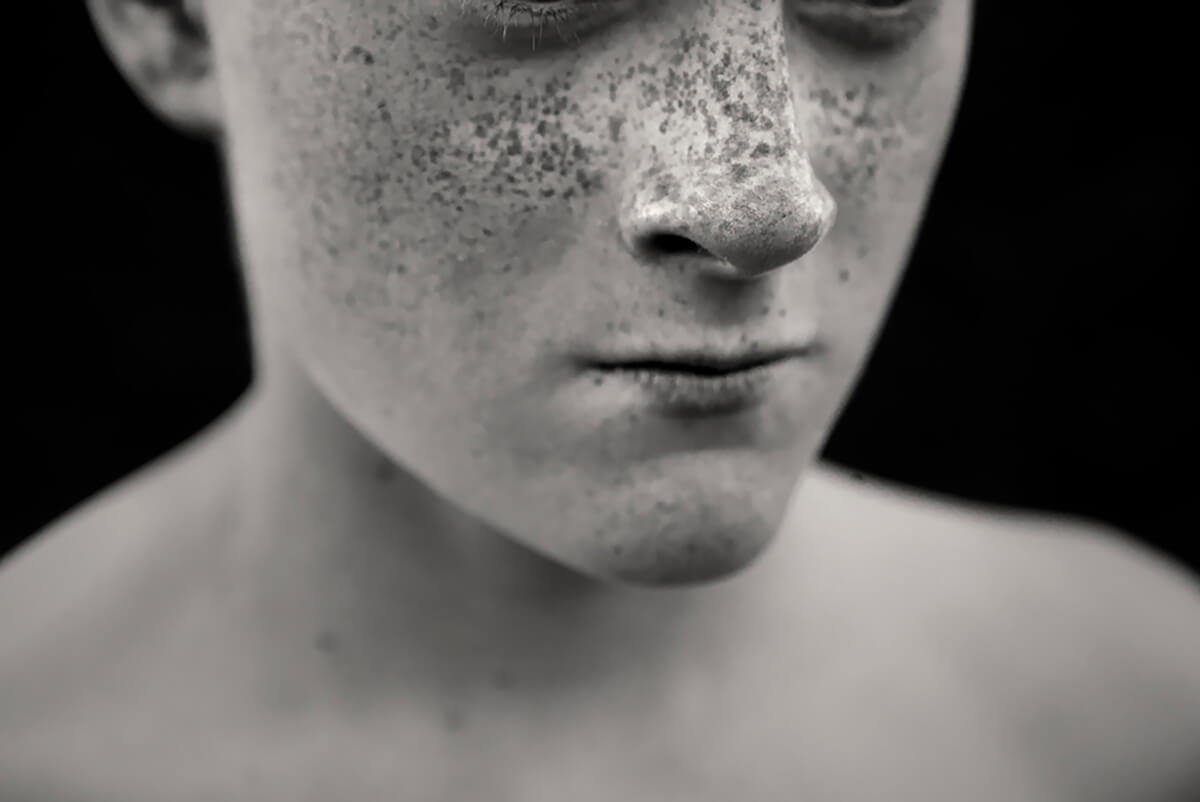Freckles<p>© Rebecca Moseman</p>