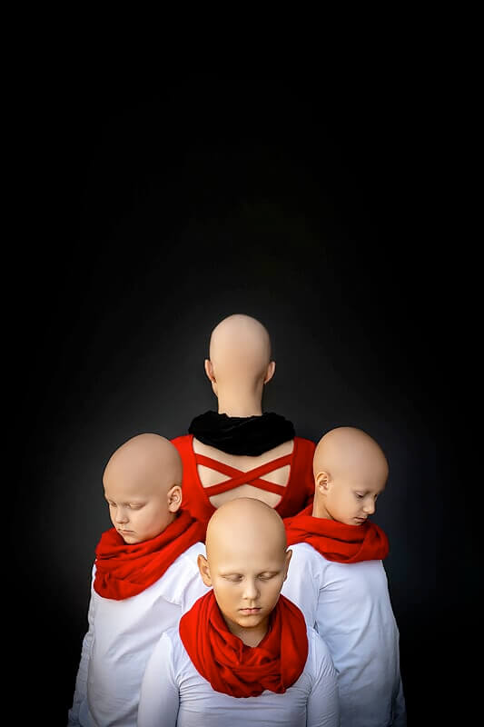 Alopecie<p>© Milos Nejezchleb</p>