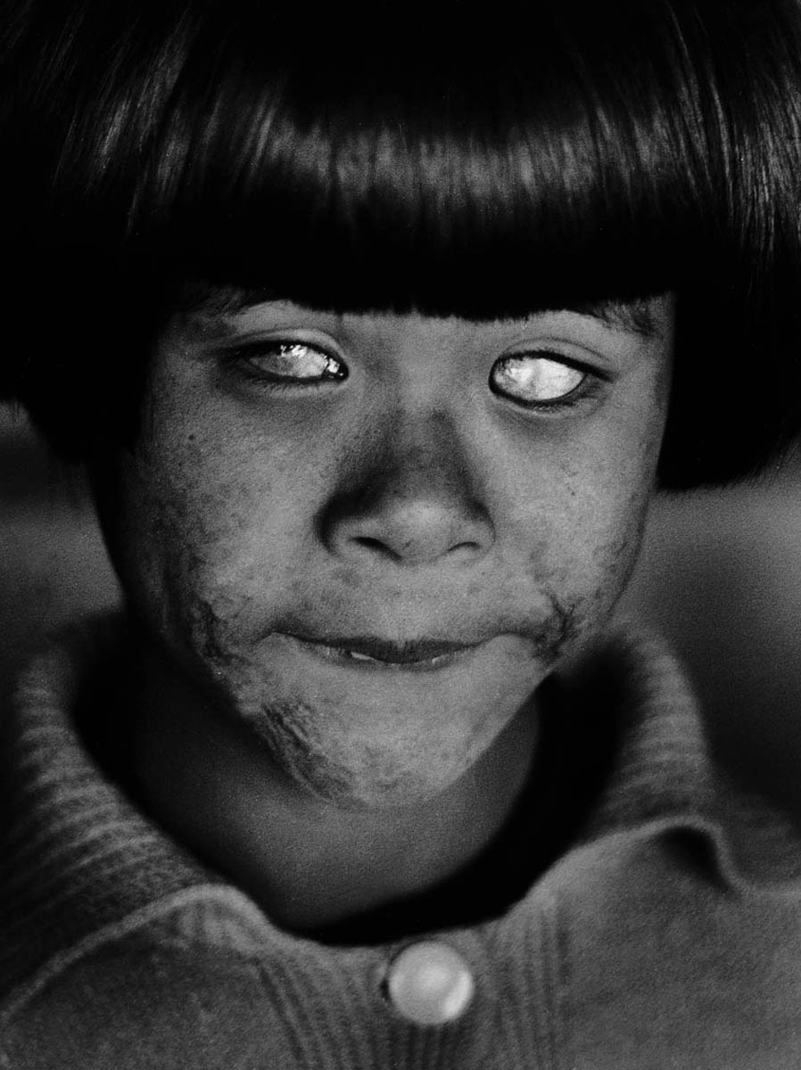 The blind girl - Hiroshima 1963<p>© Christer Strömholm</p>